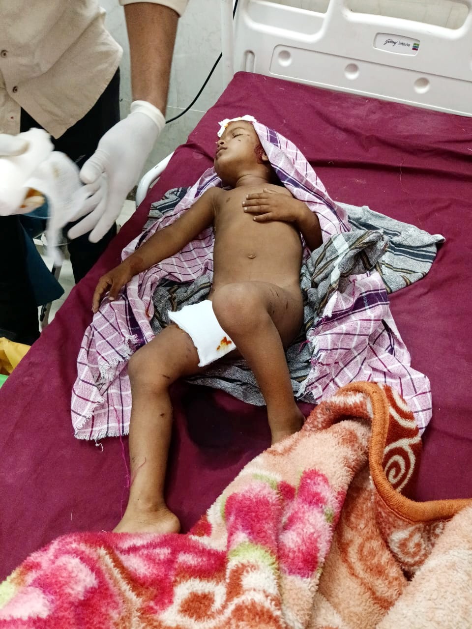 ઈડરના બરવાવમાં રમતા બાળકને શ્વાનએ બચકા ભરતાં ઈજાગ્રસ્તને સારવાર માટે લવાયો.